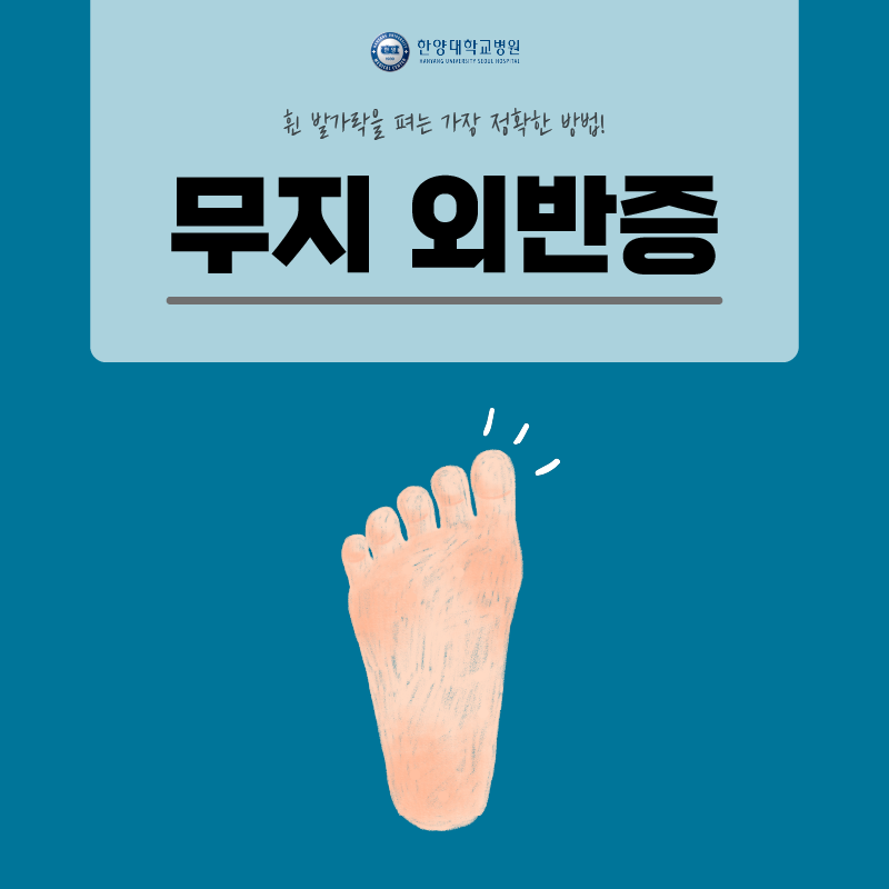 휜 발가락 펴는 가장 정확한 방법!